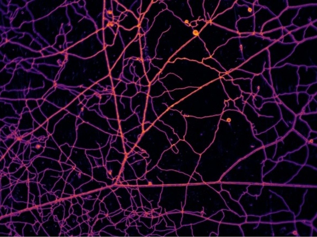 Study maps quadrillion-mile fungus web lurking in topsoil