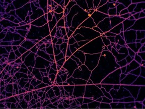 A microscopic image of network formed by arbuscular mycorrhizal fungi