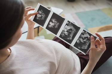 A pregnant woman holding ultrasound images of a fetus.