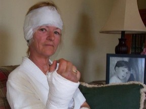 Former Canada Post letter carrier Darlene Wagner, seen here in this file photo from June 2004, shortly after being attacked by two pit bull-type dogs while delivering mail in a north Chatham neighbourhood, (Postmedia file photo)