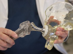 In this Wednesday, March 5, 2014 photo, Dr. Joshua Jacobs, orthopedics surgery chief at Rush University Medical Center and president of the American Academy of Orthopaedic Surgeons in Chicago, holds a model of a cementless hip replacement. About two of every 100 Americans now has an artificial joint, doctors are reporting. That's  2.5 million with a new hip and 4.7 million with a new knee, according to the first major study to look at how common these operations have become. Results were reported Tuesday, March 11, 2014 at an American Academy of Orthopaedic Surgeons conference in New Orleans. (AP Photo/M. Spencer Green) ORG XMIT: POS2014110714535036