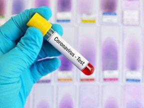 The Haldimand-Norfolk Health Unit reported six new cases of COVID-19 in the health district Friday morning. -- File photo