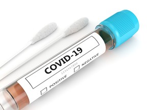 3d render of covid-19 nasal swab laboratory test over white