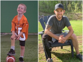 Adam Kingsmill lost his right leg below the knee at the age of 2. He is now a local advocate for The War Amps CHAMP Program. Adam is pictured in 2005, left, and today at age 20, right. Photo Supplied.
