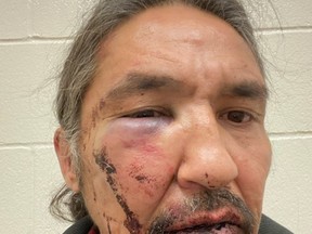 Chief Allan Adam of the Athabasca Chipewyan First Nation after he was arrested on March 10, 2020 in downtown Fort McMurray. Supplied Image/ACFN