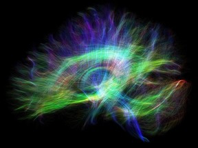 An example of diffusion spectrum imaging (DSI) from Queen's new Prisma magnetic resonance imaging (MRI). Some of the most beautiful images generated by MRI are created by imaging the diffusion (movement) of water throughout the brain. From this diffusion, we can generate maps of the neuron connections that are responsible for carrying messages from one area of the brain to another. Seen here, they are coded by direction, such that blue tracts move from foot to head, red tracts move from left to right in the head, and green tracts move from the front to the back of the head. There are 30,000 tracts displayed in this image. By adulthood, the average person has about 160,000 kilometres total length of these tracts. Donald Brien of the Centre for Neuroscience Studies' image The Wiring of the Brain won the Art in Action category.