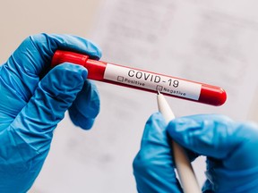 Covid-19 text. A hands of doctor, nurse, scientist writes with a pen and confirms the negative result, hold a test tube with biological sample. Coronavirus. Blood is dont infected. New cases of cure.

Model Released (MR)