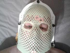 Rick Nelson had to wear this mast for his radiation treatment for a brain tumour.TP.jpg