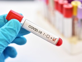 Blood sample tube positive with COVID-19