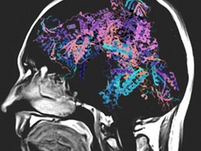 While they share the executive function of controlling systems, computers and human brains are as alike as chalk and cheese in how they work and their capabilities. writes columnist Tim Philp.