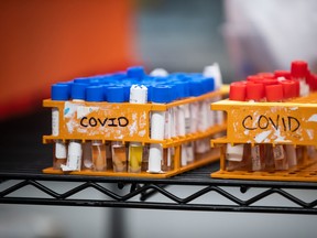 Specimens to be tested for COVID-19 are gathered at a LifeLabs facility in B.C.