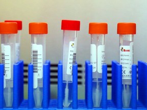 Patient swabs await testing for COVID-19 Tuesday, Aug. 25, 2020 in the medical microbiology laboratory of Belleville General Hospital in Belleville, Ont. The pandemic has increased hospitals' costs while cutting revenue. Luke Hendry/The  Intelligencer/Postmedia Network