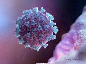A computer image created by Nexu Science Communication together with Trinity College, shows a model structurally representative of a betacoronavirus which is the type of virus linked to COVID-19. NEXU Science Communication/via REUTERS

NARCH/NARCH30