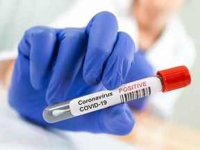 Coronavirus Infected Swab Test Sample in Doctor Hands. COVID-19 Epidemic and Virus Outbreak.

Model and Property Released (MR&PR)