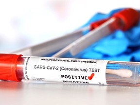 Coronavirus test concept - vial sample tube with cotton swab, red checkmark next to word positive, blurred vials and blue nitrile gloves background. (Sticker is own design with dummy data)

Not Released (NR)