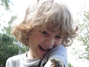 Oliver Shorthouse was surprised when this treefrog jumped onto his upper arm. See story, additional photo on page A3.