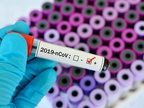 Blood sample tube positive with novel coronavirus 2019