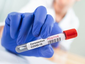 Coronavirus Infected Swab Test Sample in Doctor Hands. COVID-19 Epidemic and Virus Outbreak.

Model and Property Released (MR&PR)