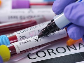 Coronavirus, COVID-19 blood test macro closeup shoot. Coronavirus NCOV test positive negative results. Medical photo still. Marking blood test concept.

Not Released (NR)