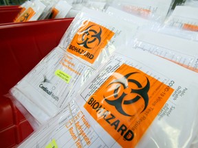 Testing kits for COVID-19 testing kit lie in bins in the medical microbiology laboratory of Belleville General Hospital.