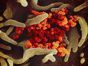 This undated electron microscope image made available by the U.S. National Institutes of Health in February 2020 shows the Novel Coronavirus SARS-CoV-2, orange, emerging from the surface of cells, green, cultured in the lab. Also known as 2019-nCoV, the virus causes COVID-19. The sample was isolated from a patient in the U.S.