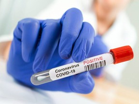 Coronavirus infected blood sample tube