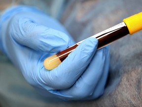 Blood is drawn for an antibody test for the coronavirus.
Getty Images Photo