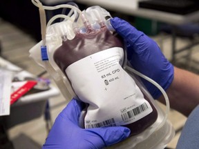 A bag of blood is shown at a clinic Thursday, November 29, 2012 in Montreal. Eric Duncan, the first openly gay Conservative MP, laced into the federal health minister Thursday over the Liberals failure to end a ban on gay men donating blood.