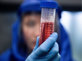 A scientist displays a test sample during diagnostic activity relating to SARS-CoV-2, the virus strain causing the coronavirus disease, at the Szentgothai Research Center, University of Pecs, in Pecs, Hungary. PHOTO BY AKOS STILLER /Bloomberg