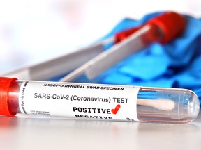 Coronavirus test concept - vial sample tube with cotton swab, red checkmark next to word positive, blurred vials and blue nitrile gloves background. (Sticker is own design with dummy data)