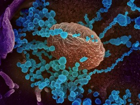 This handout illustration dated Feb. 27, courtesy of the National Institutes of Health, shows SARS-CoV-2 (round blue objects) emerging from the surface of cells cultured in the lab. SARS-CoV-2, also known as 2019-nCoV, is the virus that causes COVID-19.