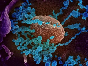 This image courtesy of The National Institutes of Health(NIH)/NIAD-RML shows a scanning electron microscope image of SARS-CoV-2 (round blue objects) emerging from the surface of cells cultured in the lab. SARS-CoV-2, also known as 2019-nCoV, is the virus that causes COVID-19.