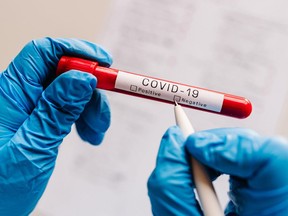 Covid-19 text. A hands of doctor, nurse, scientist writes with a pen and confirms the negative result, hold a test tube with biological sample. Coronavirus. Blood is dont infected. New cases of cure.