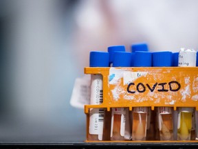 COVID-19 specimens await testing. THE CANADIAN PRESS/Darryl Dyck