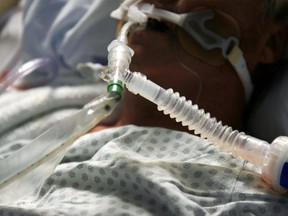 File photo of a patient on a ventilator while being treated for COVID-19. PHOTO BY Callaghan O'Hare/REUTERS