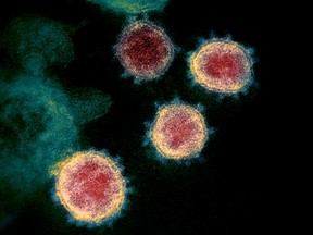 FILE PHOTO: Transmission electron microscope image shows SARS-CoV-2, also known as novel coronavirus