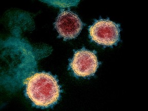 FILE PHOTO: Transmission electron microscope image shows SARS-CoV-2, also known as novel coronavirus