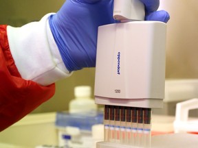 Medical laboratory technologist Danielle Lalonde uses an electronic pipette Aug. 25 while working in the medical microbiology laboratory of Belleville General Hospital. The lab conducts testing for COVID-19 and other illnesses.