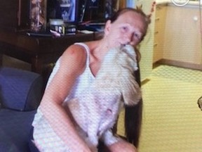 Elizabeth Arnold holds her dog Diamond at her home in Warren on Wednesday. The shihtzu was attacked late last week by another dog in the community and is still recovering from its wounds.