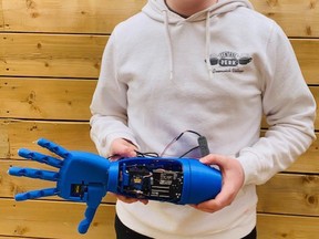 Cooper LeSauvage, 14, a Grade 8 student at Holy Family School in Hanover, with his project of a 3D printed robotic prosthetic hand and forearm. LeSauvage won gold and the Youth Can Innovate Award in the Canada-Wide Science Fair, which is an annual fair in Canada coordinated by Youth Science Canada. This occurred virtually this year from May 17-21.