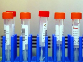 Patient swabs await testing for COVID-19
