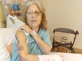 Lisa Noble is recovering from serious injuries after being repeatedly struck with a golf club during an assault on Albert Street East on Oct. 12. SUPPLIED