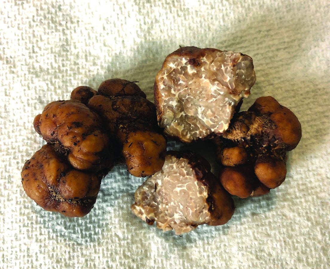 Truffles offer double crop for nut tree growers Ontario Farmer