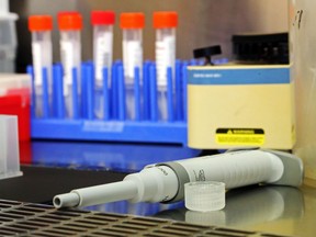 A pipette used for testing samples (background) for COVID-19 rests on a workstation in the medical microbiology laboratory of Belleville General Hospital.