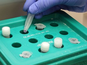 A laboratory technologist at Belleville General Hospital handles COVID-19 samples. Five people with the virus were inpatients there as of Wednesday. Two were in intensive care.