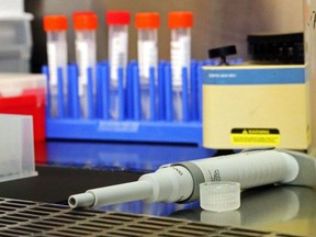 A pipette used for testing samples (background) for COVID-19 rests on a workstation.