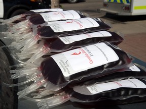 Canadian Blood Services' blood donations in Edmonton. July 3, 2015. Photo by Bruce Edwards / Postmedia Network