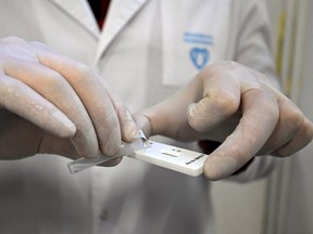 A medical specialist performs a rapid antigen test for the coronavirus disease (COVID-19).