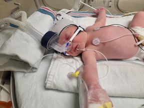 Ethan Robert Tremblay, seen in the neonatal intensive care unit at Kingston General Hospital, is the 2022 New Year's baby in Kingston, born just before 3 a.m. on Jan. 1, 2022, and arriving 10 days early to thrilled parents Janice and Joel Tremblay.