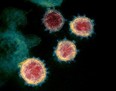 FILE PHOTO: Transmission electron microscope image shows SARS-CoV-2, also known as novel coronavirus